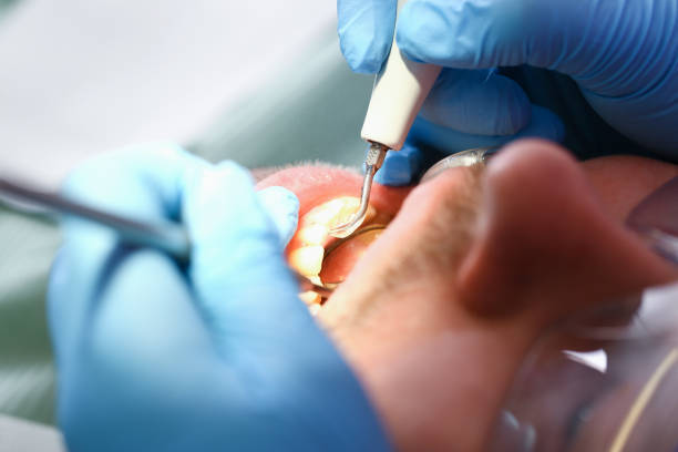 Best Broken Tooth Emergency  in Westmont, CA